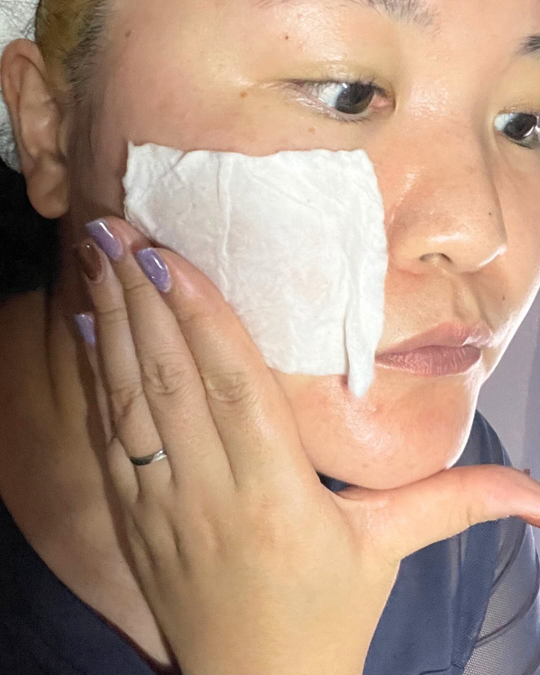 ハーバルケアローション/シュラメック/化粧水を使ったクチコミ(5枚目)