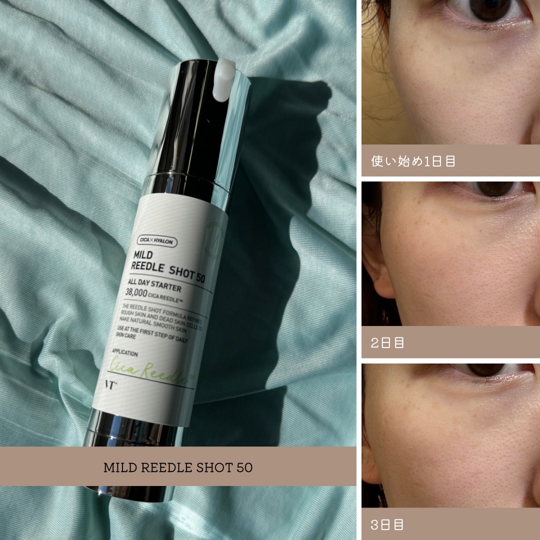 リードルショット1000/VT/ブースター・導入液を使ったクチコミ（2枚目）