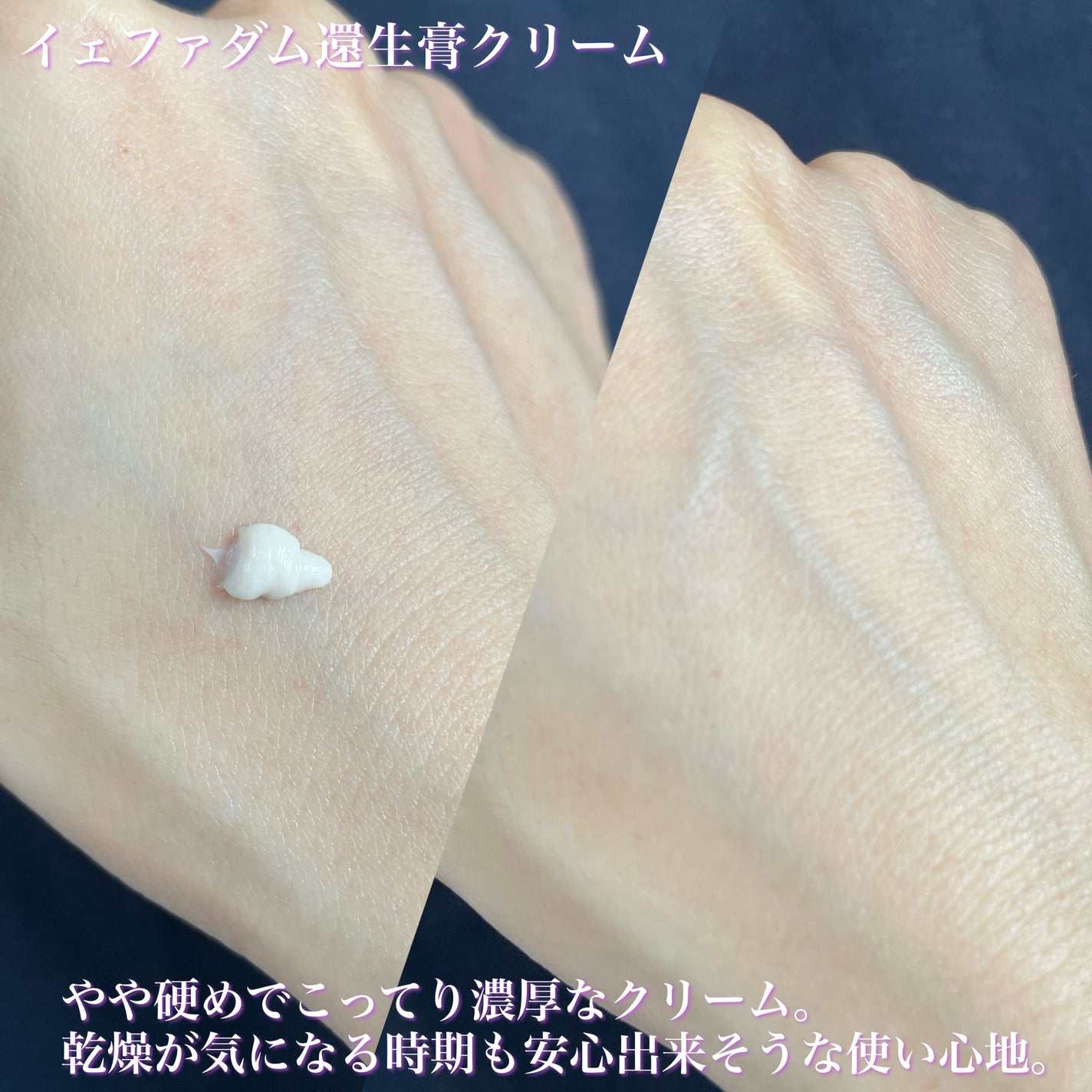 イェファダム還生膏 保潤 2種スペシャルセット/THE FACE SHOP/スキンケアキットを使ったクチコミ(6枚目)