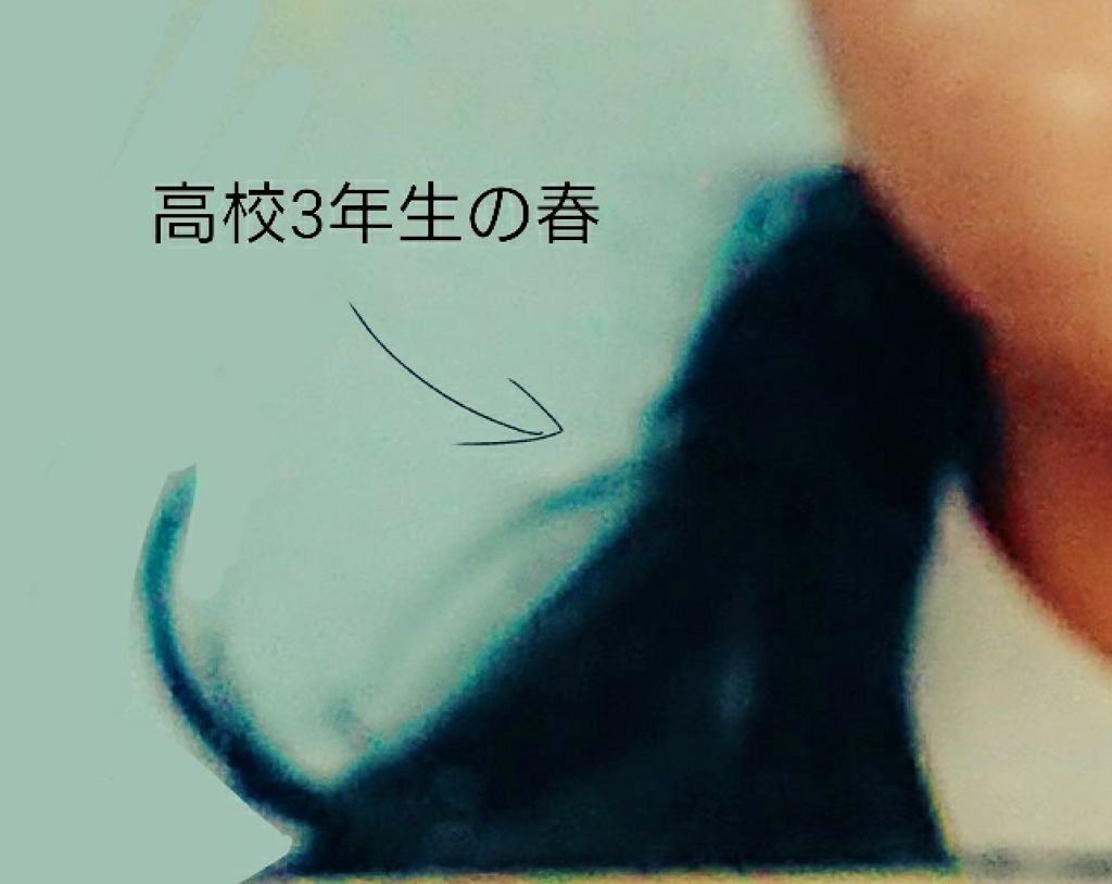 3種のヒアルロン酸配合 美容液/DAISO/美容液を使ったクチコミ（1枚目）