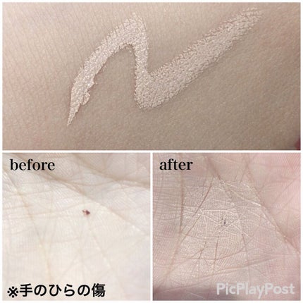 湘南美容コンシーラー/湘南美容/スティックコンシーラーを使ったクチコミ(3枚目)