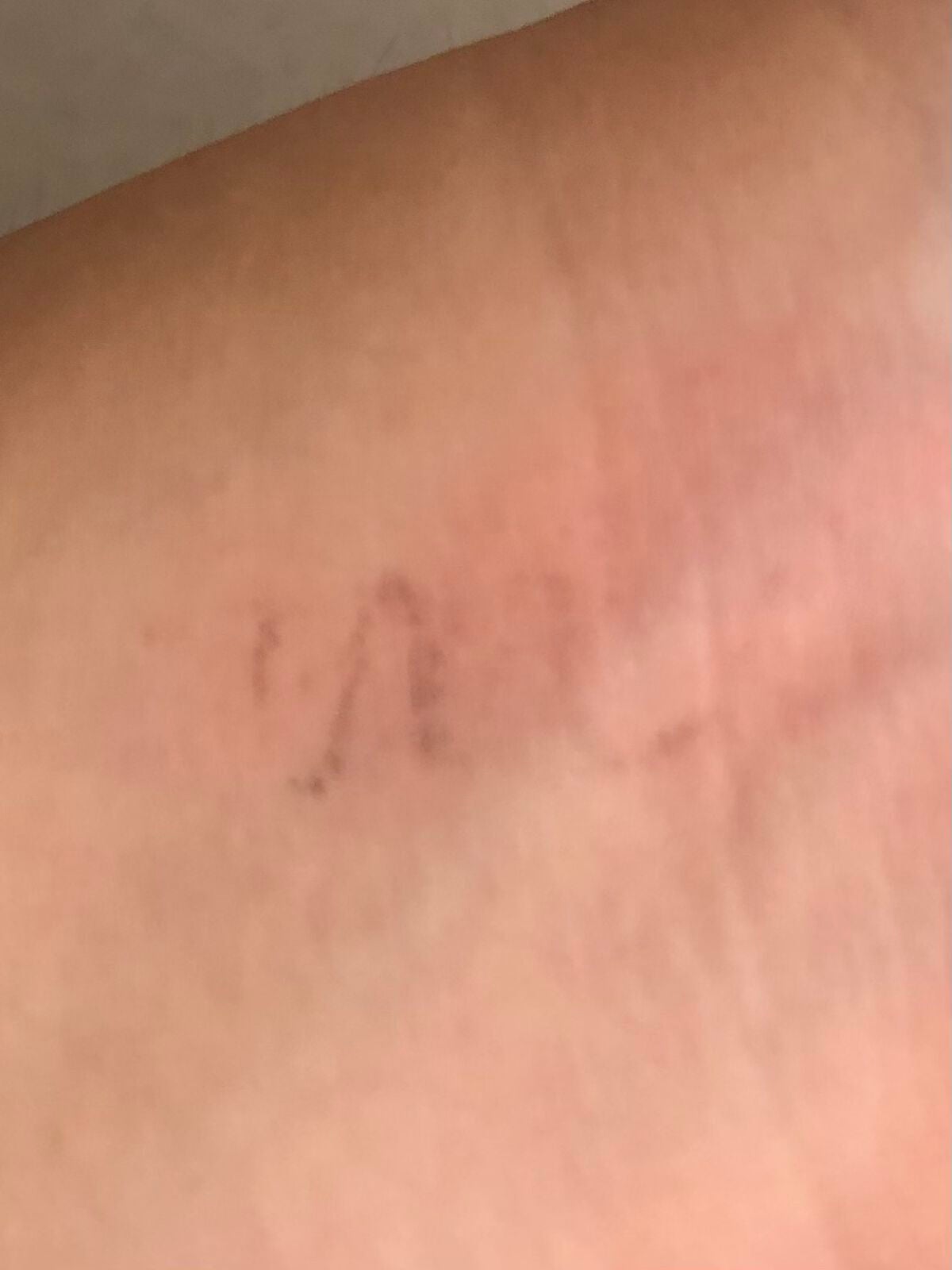 ãå¯çã¢ã€ã©ã€ããŒãã·ã§ãŒãçãªããã/ããžã£ãŽã¥/ãªãããã¢ã€ã©ã€ããŒã䜿ã£ãã¯ãã³ãïŒ4æç®ïŒ