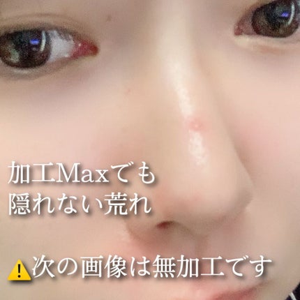 ノーモアブラックヘッド(ノーズピーリング)/One-day's you/スクラブ・ゴマージュを使ったクチコミ(2枚目)