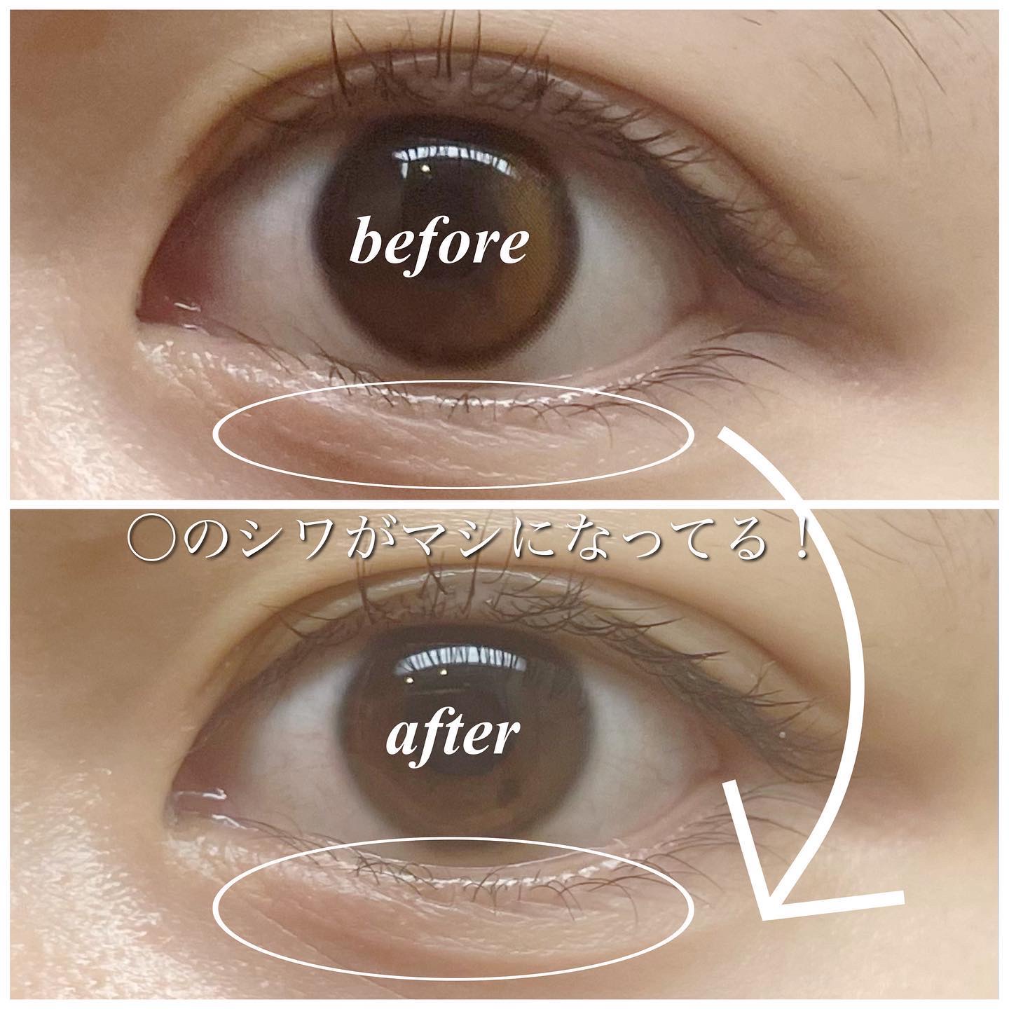 フィトコラーゲンアイセラムスティック/be wants/アイケア・アイクリームを使ったクチコミ（3枚目）