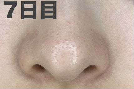 おうちdeエステ 肌をなめらかにするマッサージ洗顔ジェル 炭/ビオレ/その他洗顔料を使ったクチコミ(4枚目)