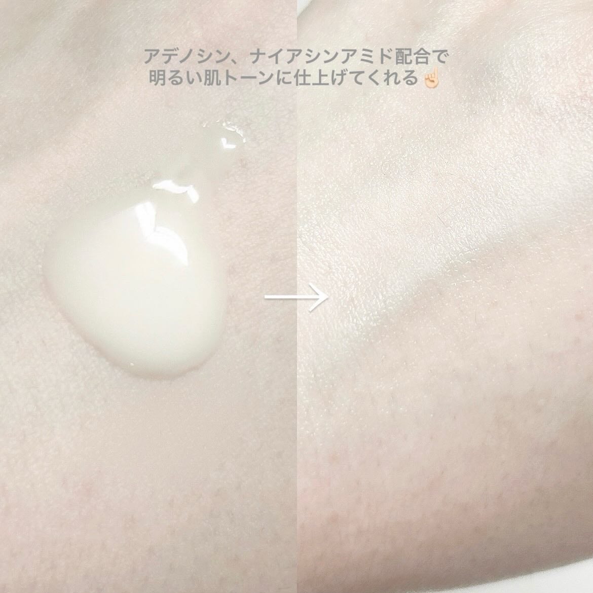 ðððâðð on LIPS ã.âŸTREEANNSEAãã»ãµã³ããã¥ãŒã³ãã¶ãŒããã¹ããã»ã¢..ãïŒ5æç®ïŒ