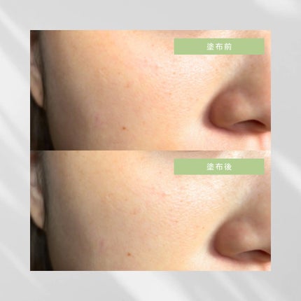 エクソソームシカセラム/MEDICUBE/美容液を使ったクチコミ(2枚目)