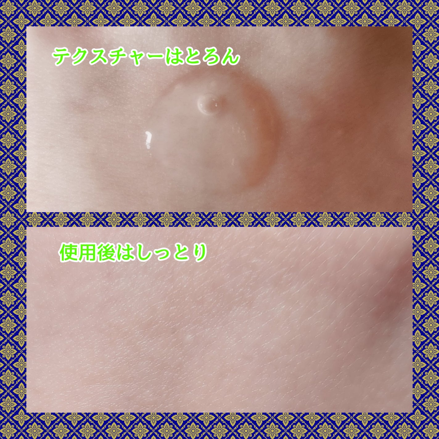 ノスカナイン トラブル セラム/FATION/美容液を使ったクチコミ(3枚目)