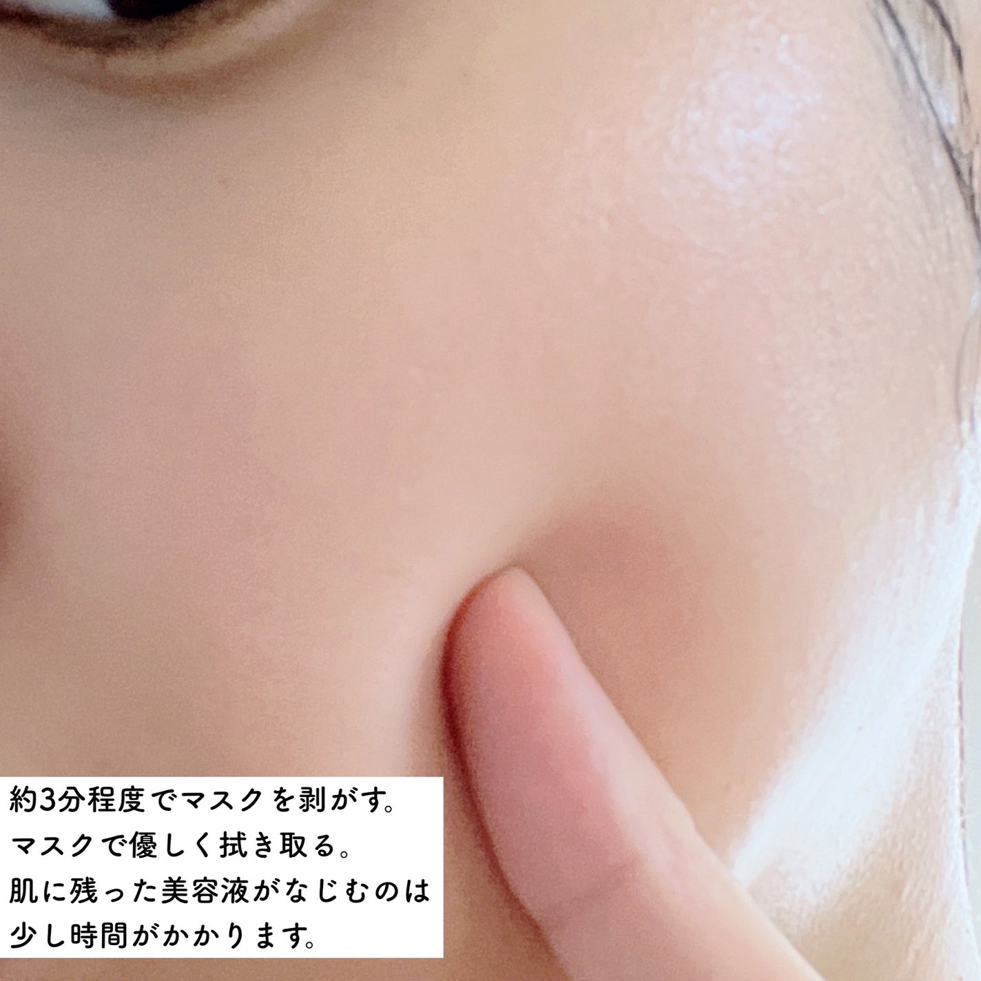 ダーマレーザースーパーVC100マスク/クオリティファースト/シートマスク・パックを使ったクチコミ(4枚目)