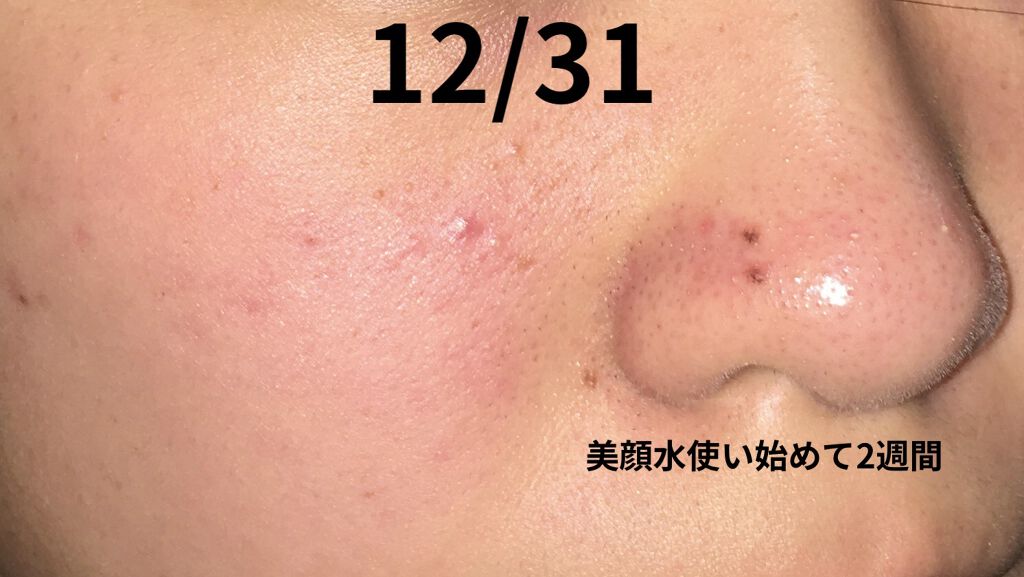 明色美顔水 薬用化粧水/美顔/化粧水を使ったクチコミ（3枚目）