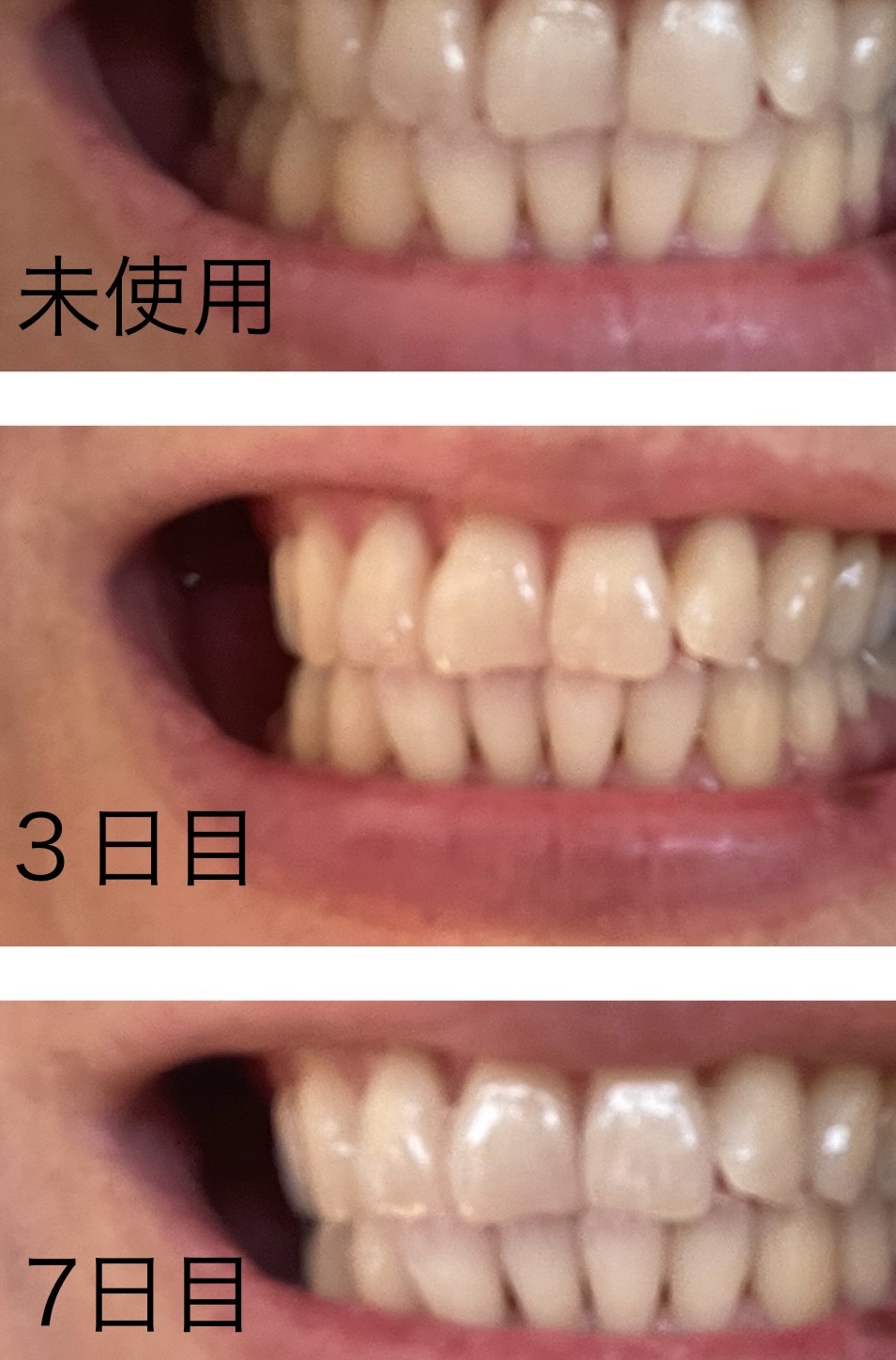 を使ったクチコミ（1枚目）