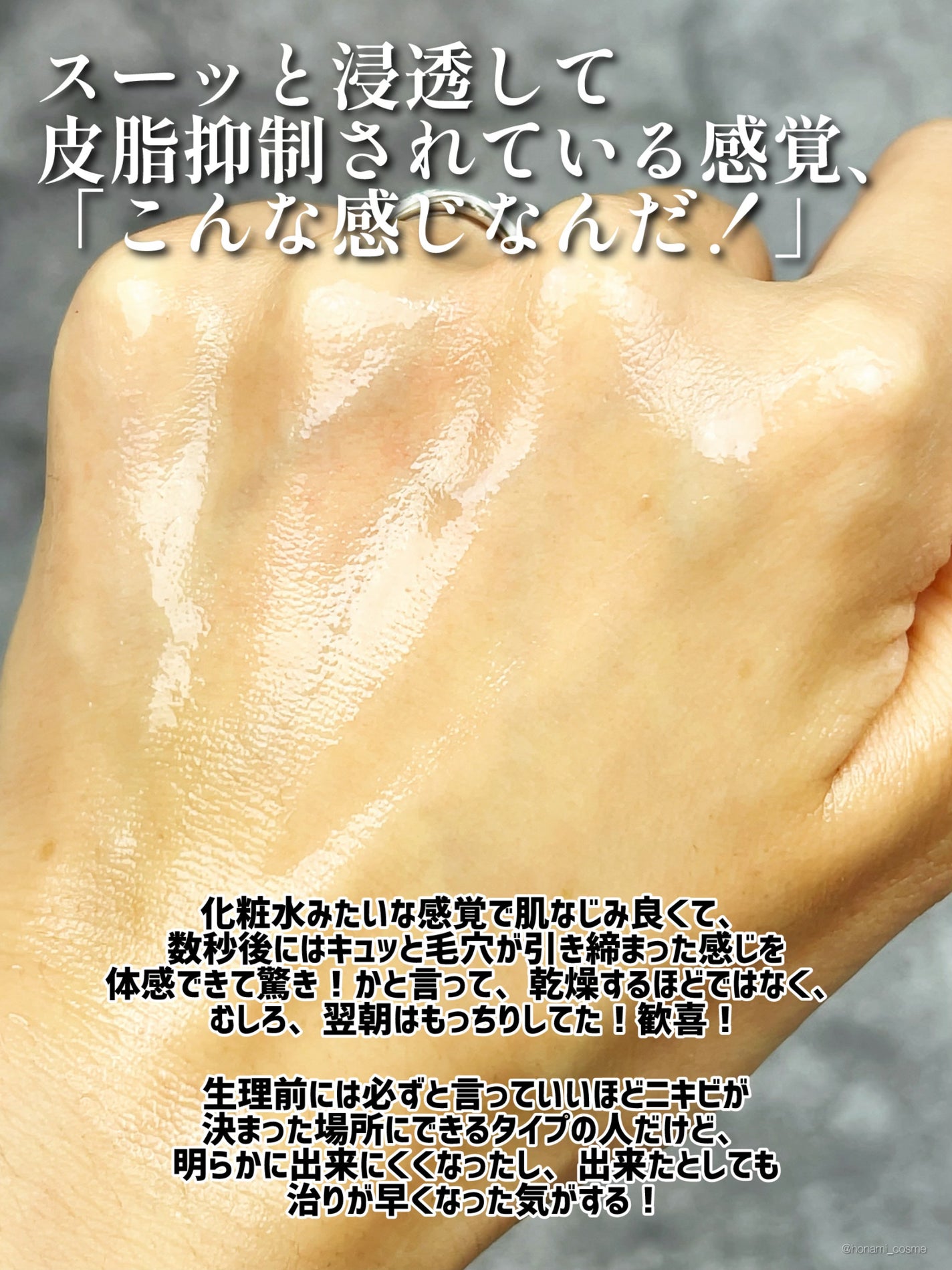 アゼライン酸15 インテンスカーミングセラム/Anua/美容液を使ったクチコミ(7枚目)