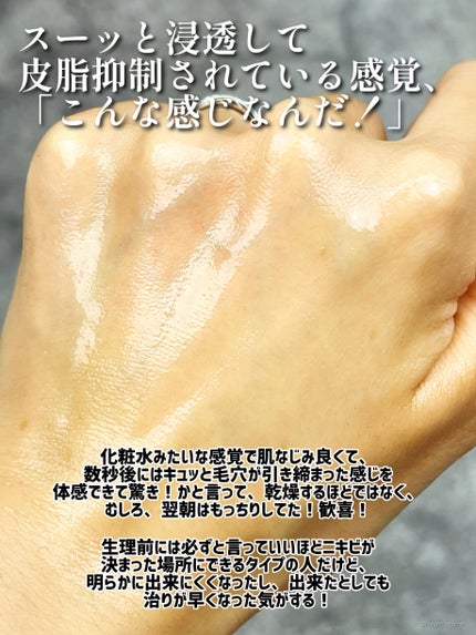 アゼライン酸15 インテンスカーミングセラム/Anua/美容液を使ったクチコミ(7枚目)