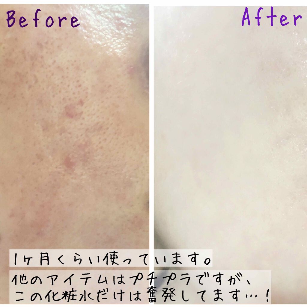 APPプラスローション GOプレミアム/ITO/ブースター・導入液を使ったクチコミ(2枚目)