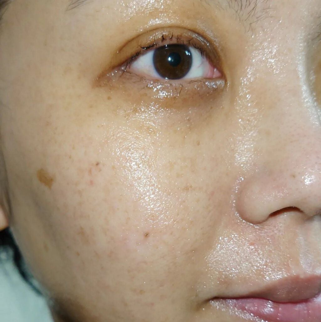 SUIKO HC ビタミン5エッセンスマスク/SUIKO HATSUCURE/シートマスク・パックを使ったクチコミ(5枚目)