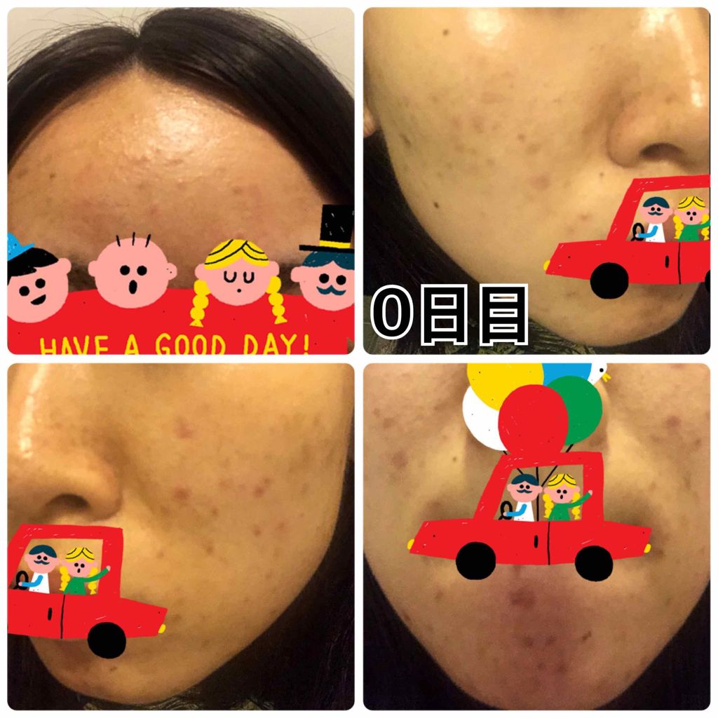 艶肌ドロップ/ラッシュ/美容液を使ったクチコミ（3枚目）