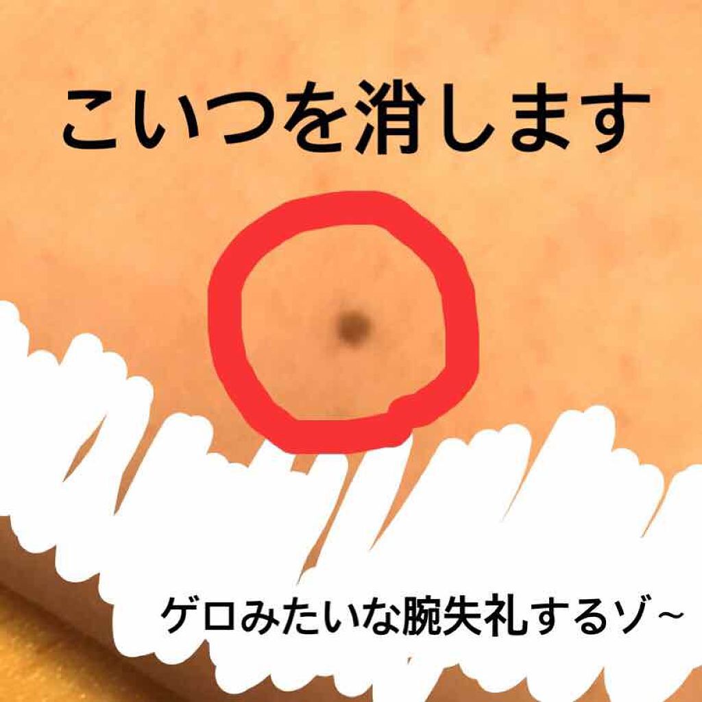 スポッツカバー ファウンデイション/SHISEIDO/クリームコンシーラーを使ったクチコミ（2枚目）