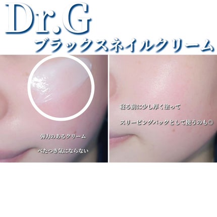 ブラックスネイル クリーム/Dr.G/フェイスクリームを使ったクチコミ(4枚目)