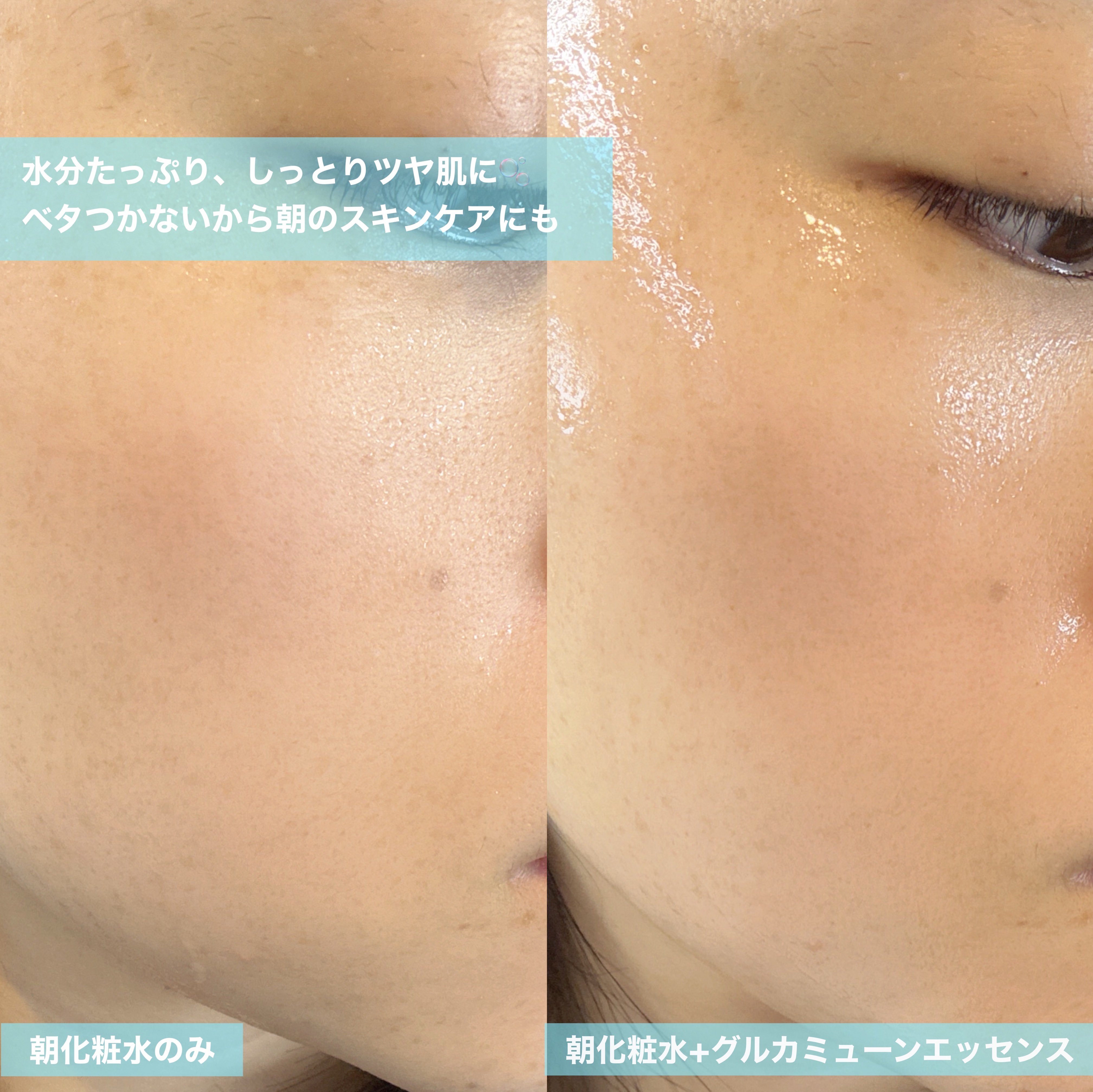 グルカミューンクリーム/VT/フェイスクリームを使ったクチコミ（3枚目）