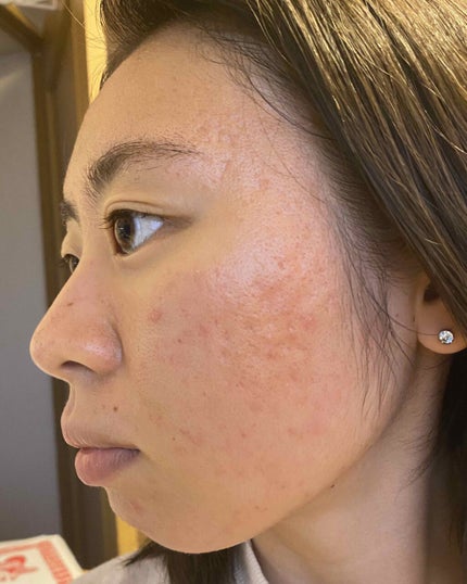 ソンバーユ無香料/尊馬油/ボディオイルを使ったクチコミ(2枚目)