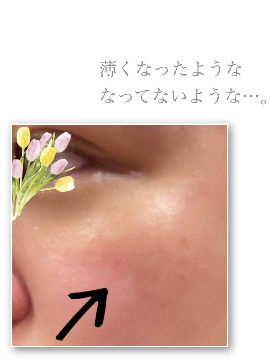 薬用しみ対策 保湿クリーム/メラノCC/フェイスクリームを使ったクチコミ(2枚目)