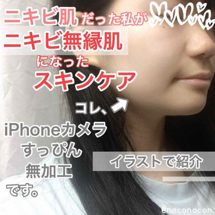 A アクネフォーム/NOV/洗顔フォームを使ったクチコミ(1枚目)