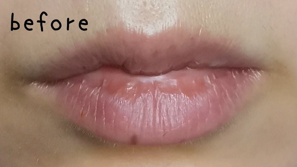 白色ワセリン(医薬品)/日本薬局方/その他を使ったクチコミ(5枚目)