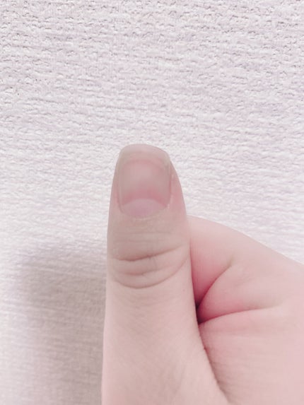 オイルジェルトリートメント/ネイルネイル/ネイルオイル・トリートメントを使ったクチコミ(5枚目)