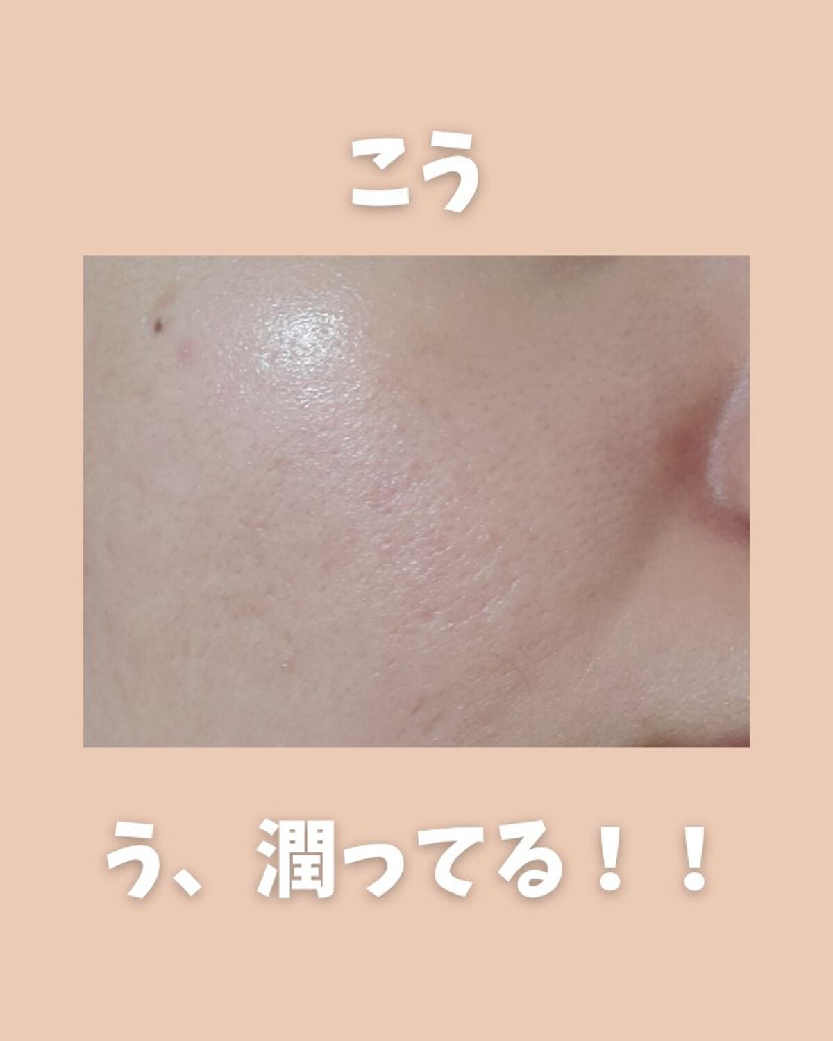 潤いバリア化粧水/ももぷり/化粧水を使ったクチコミ(5枚目)