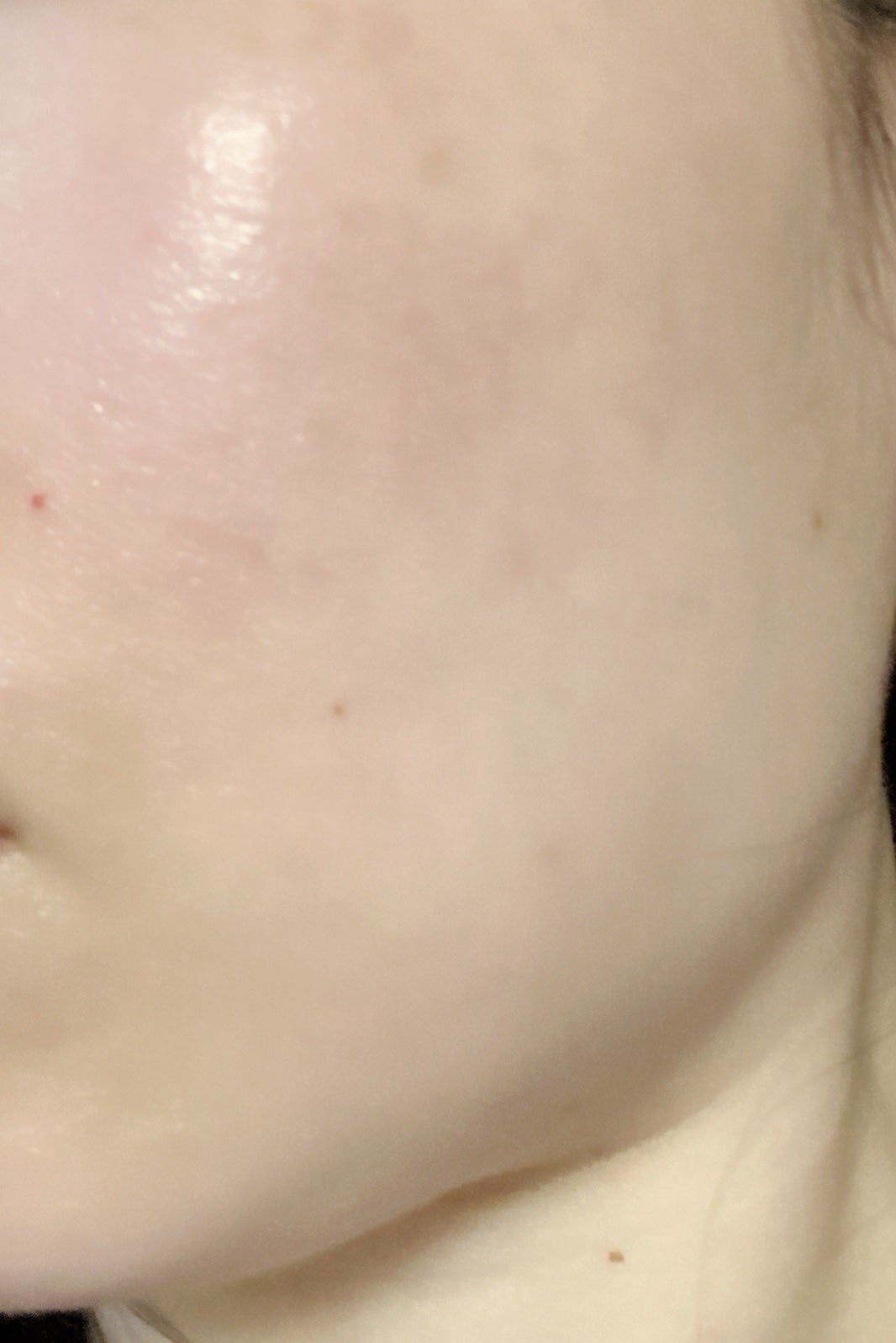 オバジC10セラム/オバジ/美容液を使ったクチコミ(2枚目)