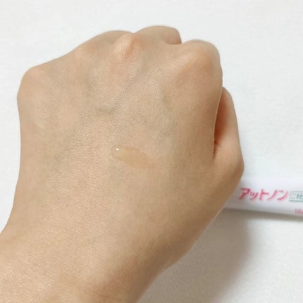 ニキビあとケアジェル/アットノン/その他スキンケアを使ったクチコミ(3枚目)