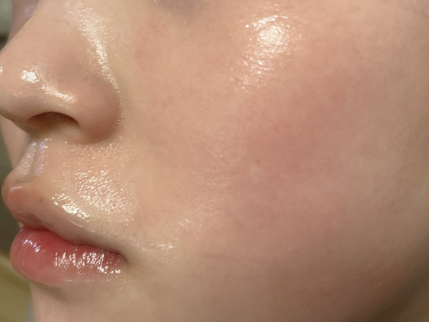 ダーマレーザー スーパー VC100 ホワイトマスク/クオリティファースト/シートマスク・パックを使ったクチコミ(3枚目)