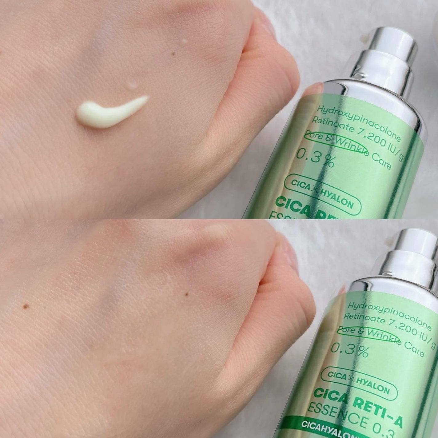 リードルショット300/VT/美容液を使ったクチコミ(5枚目)