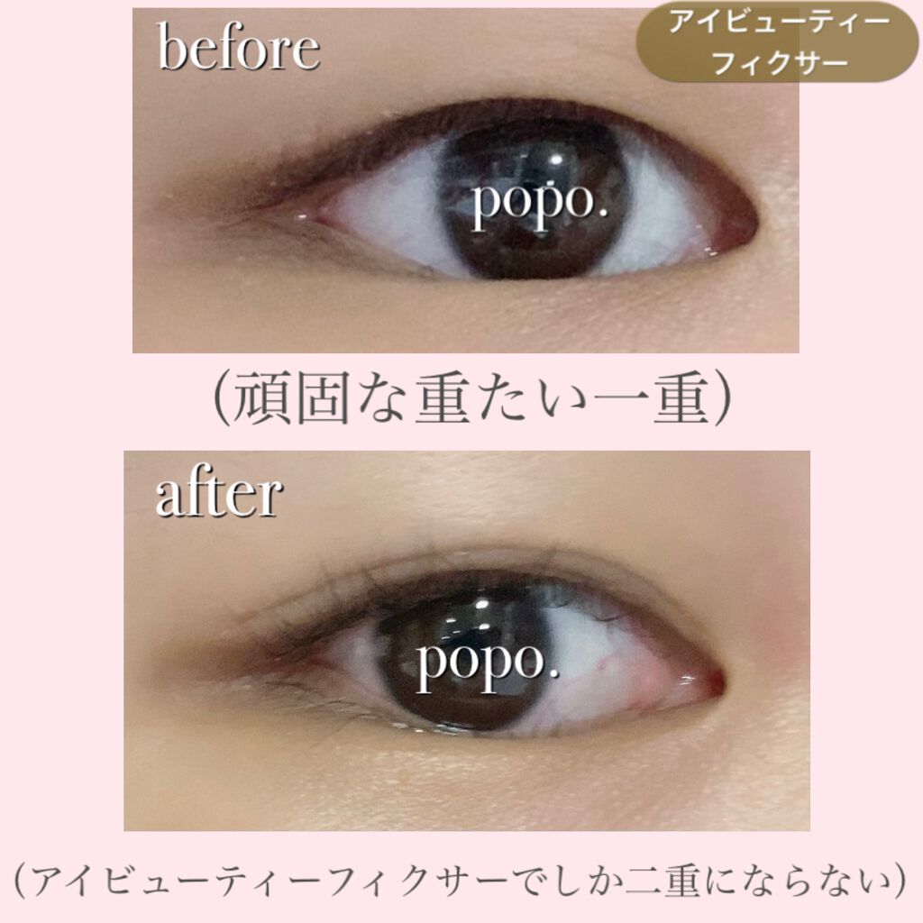 アイビューティー フィクサー WP/アストレア ヴィルゴ/二重まぶた用アイテムを使ったクチコミ（3枚目）