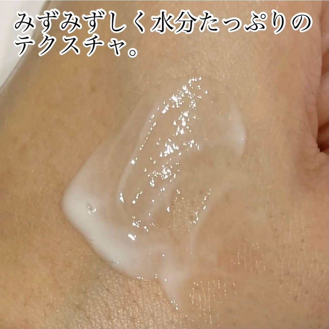 シカレチA エッセンス0.1/VT/美容液を使ったクチコミ(2枚目)