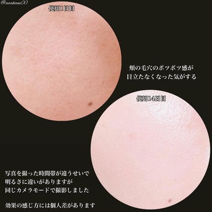 マイルドリードルショット50/VT/美容液を使ったクチコミ(4枚目)