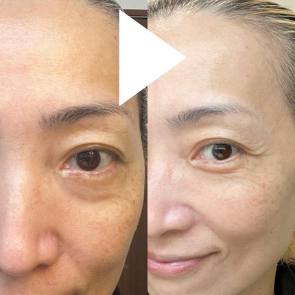 ラディアンスフィットセラムファンデーション/TFIT/リキッドファンデーションを使ったクチコミ(5枚目)