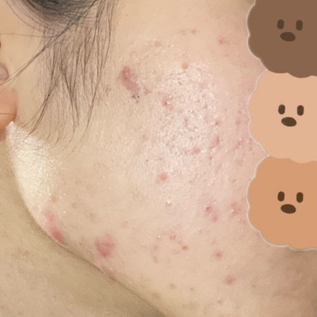 colza on LIPS 「-肌日記230107-1日でそんなに変わらないけど習慣化のため..」(3枚目)