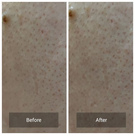 ディープクリア洗顔パウダー/ファンケル/洗顔パウダーを使ったクチコミ(5枚目)