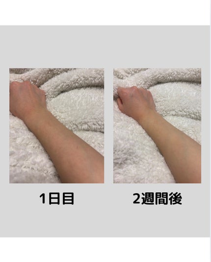 ナイアシンアミド 5% ボディローション/b.clinicx/ボディローションを使ったクチコミ(2枚目)