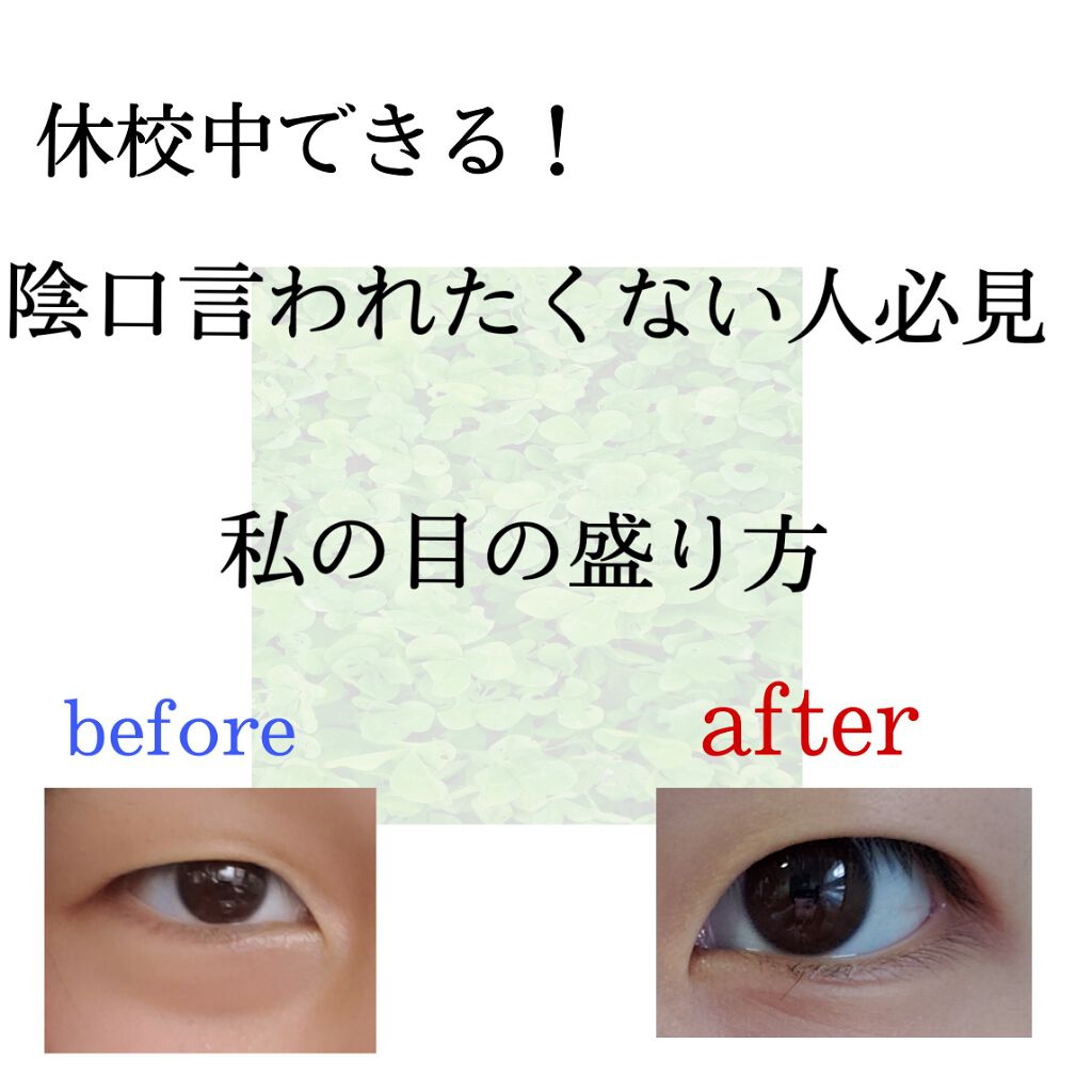 アイトーク/アイトーク/二重まぶた用アイテムを使ったクチコミ（1枚目）