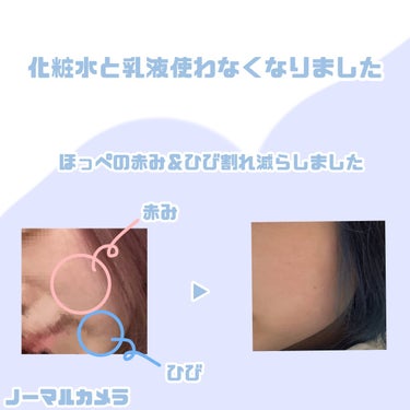 明色 美顔水 薬用化粧水/美顔/化粧水を使ったクチコミ（1枚目）