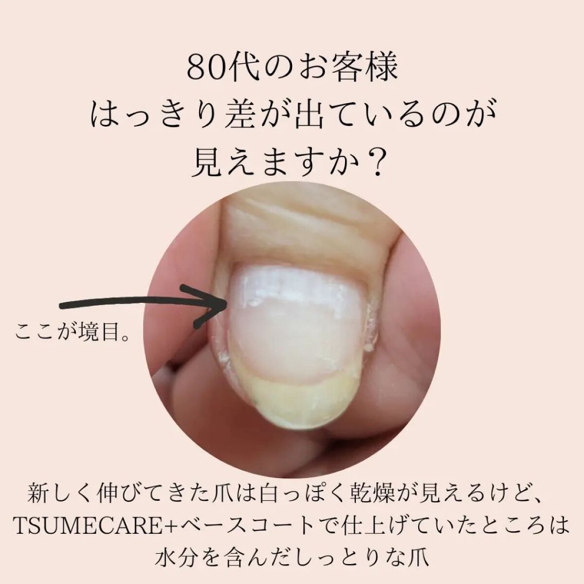 TSUMECARE/NailSalon mayunail/ネイルオイル・トリートメントを使ったクチコミ（2枚目）