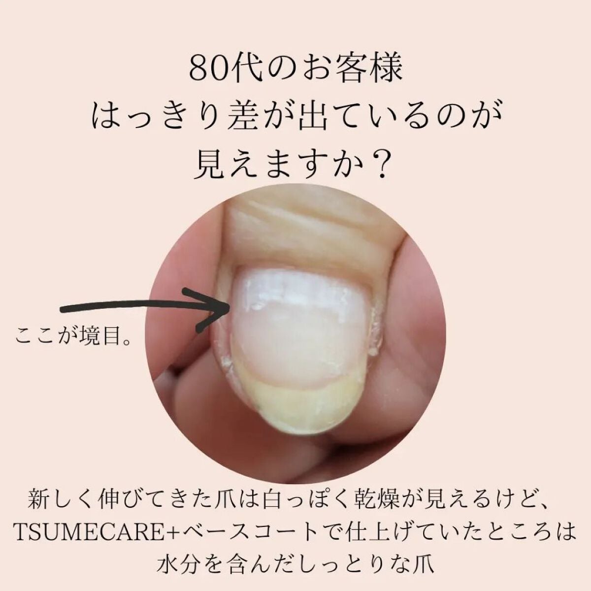 TSUMECARE/NailSalon mayunail/ネイルオイル・トリートメントを使ったクチコミ(2枚目)