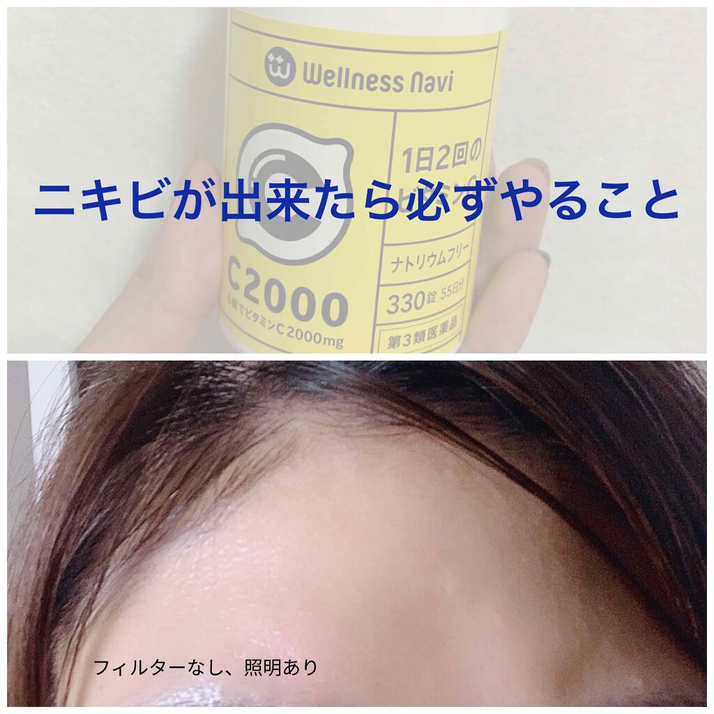 オードムーゲ 薬用ローション(ふきとり化粧水)/オードムーゲ/拭き取り化粧水を使ったクチコミ(1枚目)