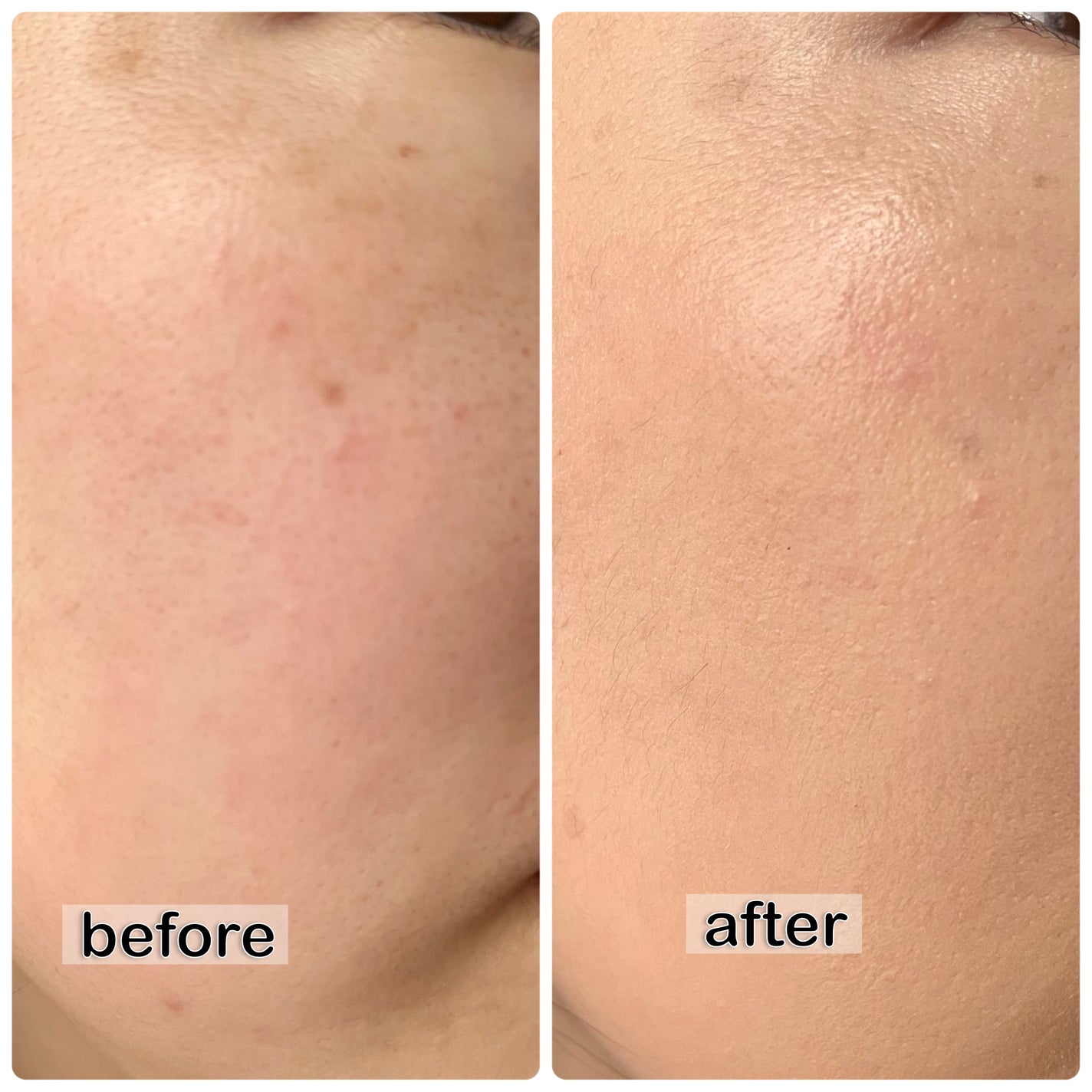 ディオールスキン フォーエヴァー フルイド グロウ/Dior/リキッドファンデーションを使ったクチコミ(4枚目)