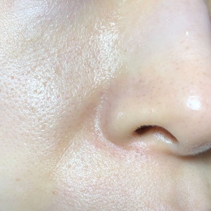 モッチスキン吸着泡洗顔 SK/MoccHi SKIN/泡洗顔を使ったクチコミ(3枚目)