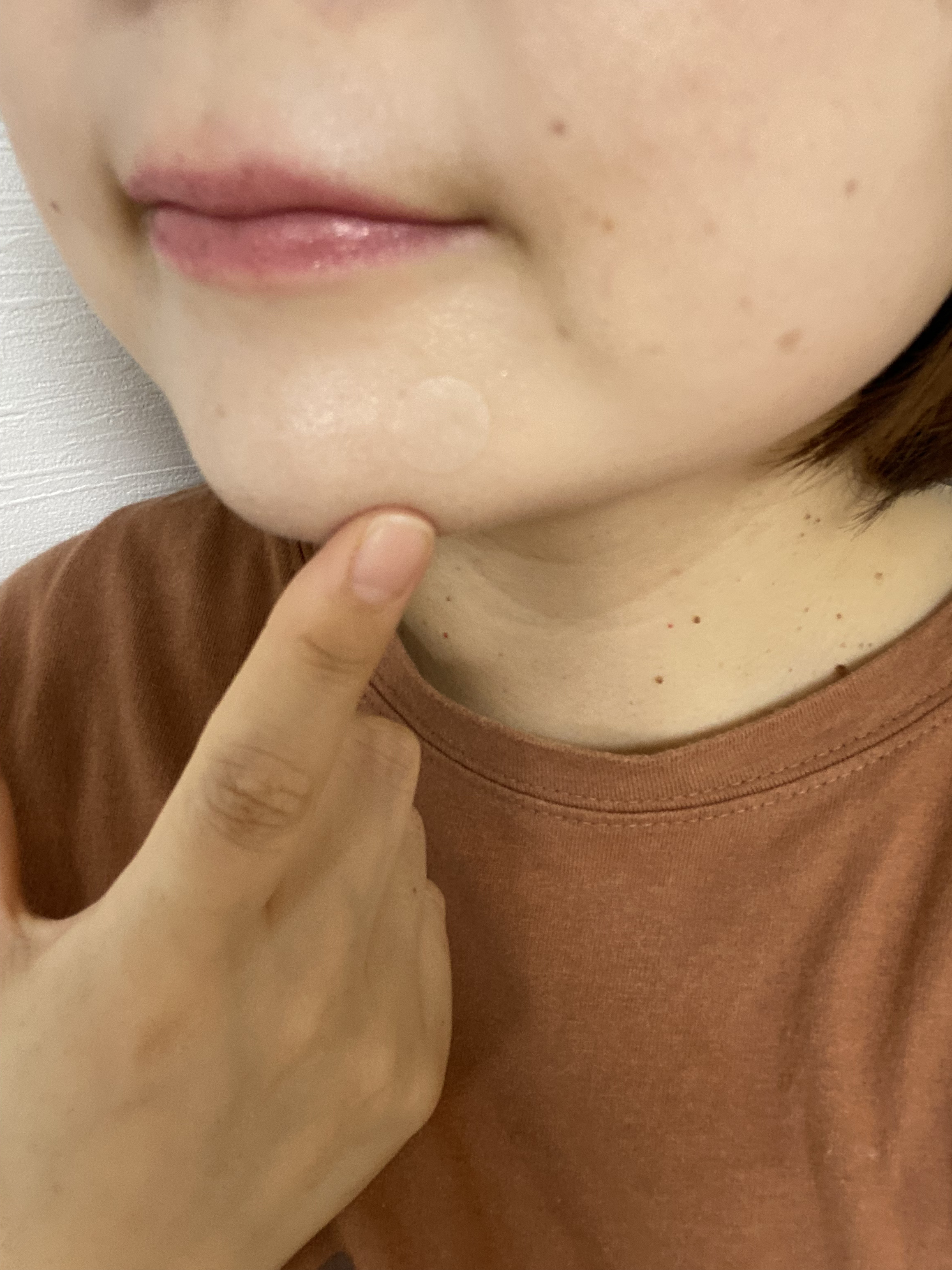 極薄透明パッチ nikipa!/金冠堂/にきびパッチを使ったクチコミ（3枚目）