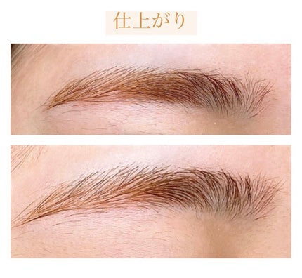 脱色クリーム スピーディー/エピラット/ムダ毛ケアを使ったクチコミ(9枚目)