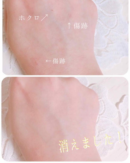 MCコレクション カバーフェイス(コンシーラー)/メイコー化粧品/クリームコンシーラーを使ったクチコミ(2枚目)